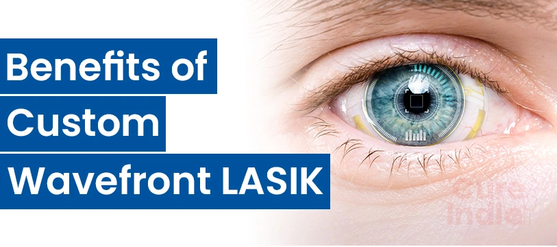 Benefits of Custom Wavefront LASIK Surgery in India